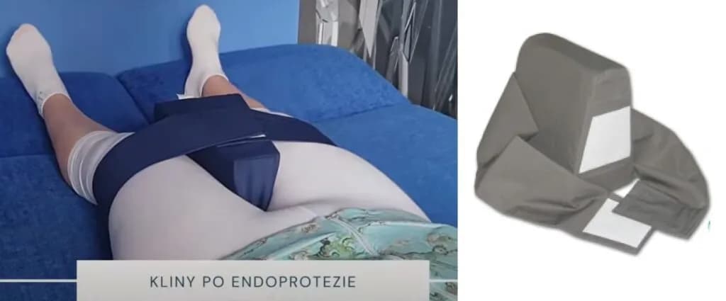 Czy po endoprotezie biodra przysługuje renta? Sprawdź warunki i pomoc