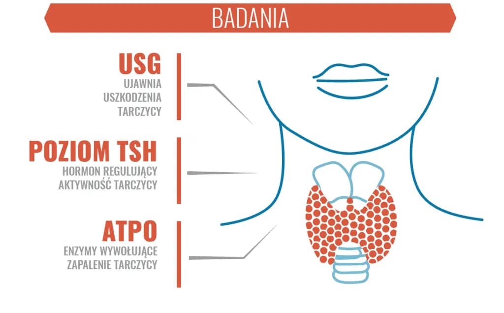 Czy choroba Hashimoto kwalifikuje do renty? Sprawdź kryteria i proces
